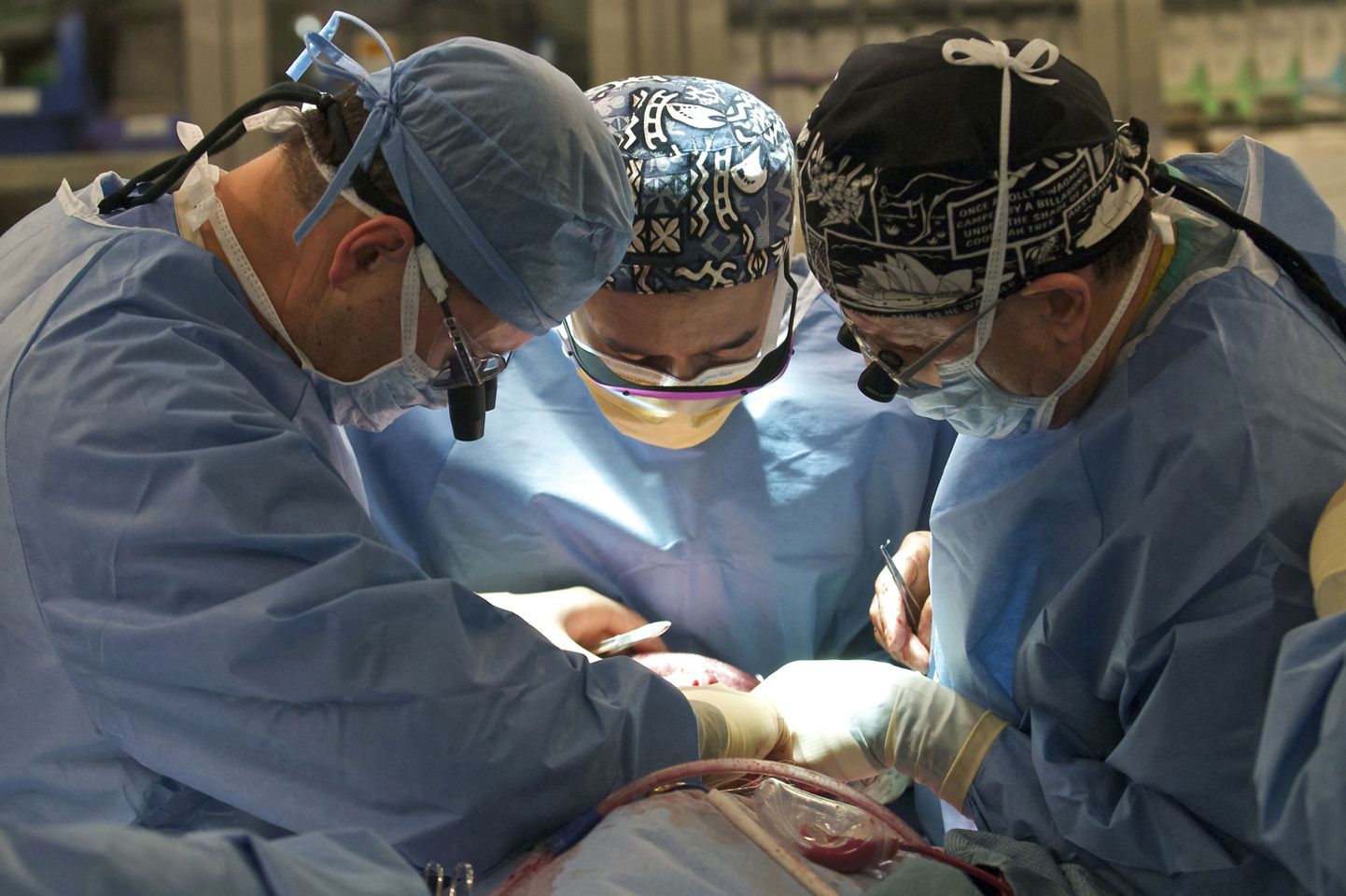 Türgis tehti 23 päeva tagasi näosiirdamise operatsioon, mille käigus õnnetuses näo kaotanu sai uue näo.