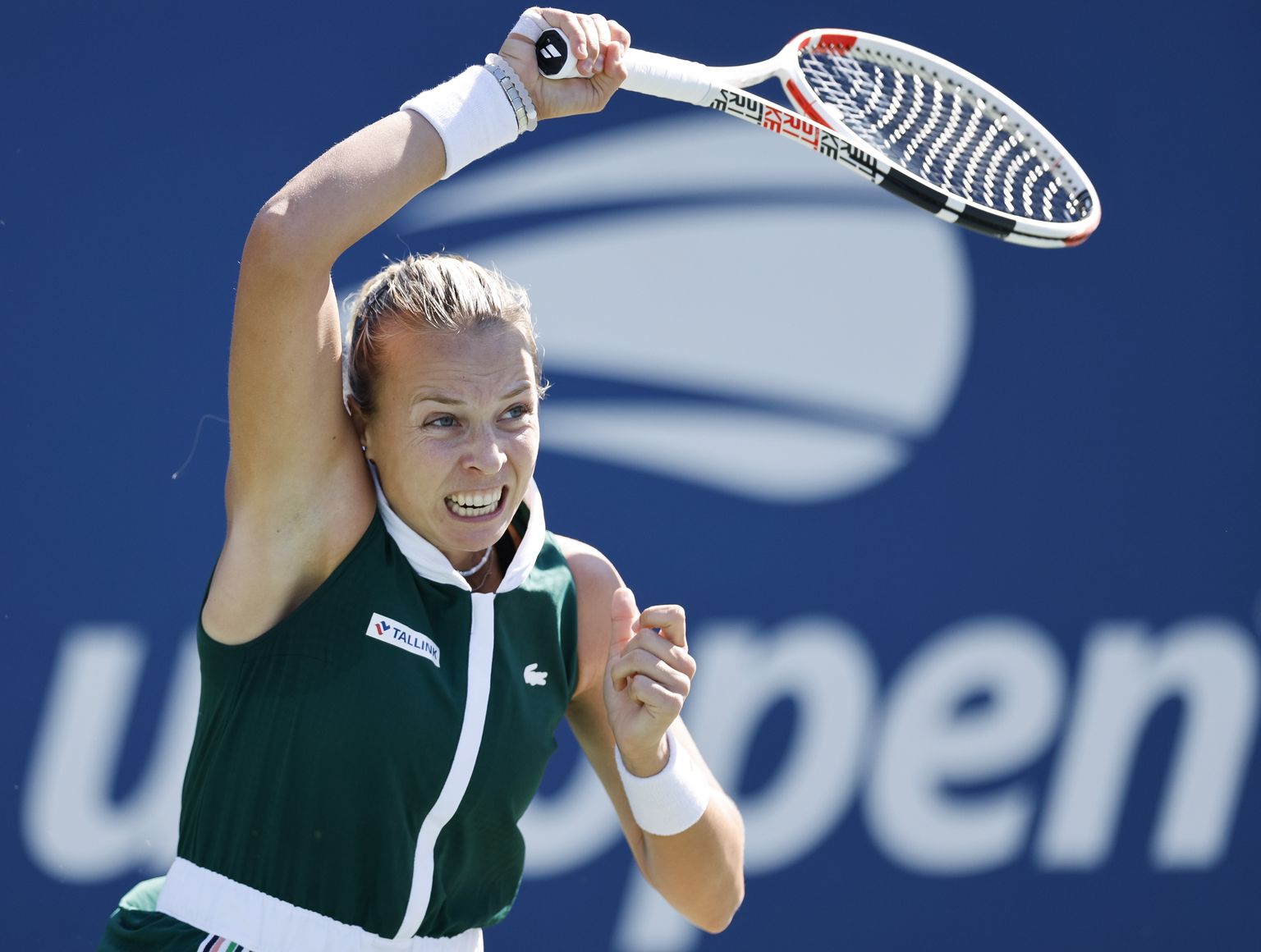 Anett Kontaveit.