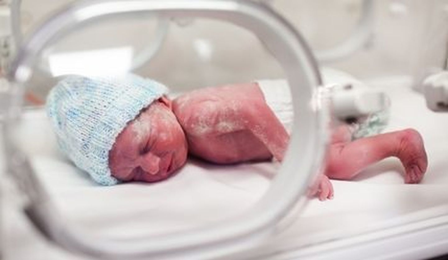 21. rasedusnädalal sündinud lapse ellujäämist peetakse imeks