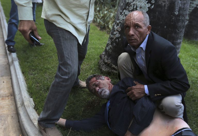 Vigastatud opositsioonisaadik Americo De Grazia eile parlamendis. Foto: Fernando Llano/AP/Scanpix