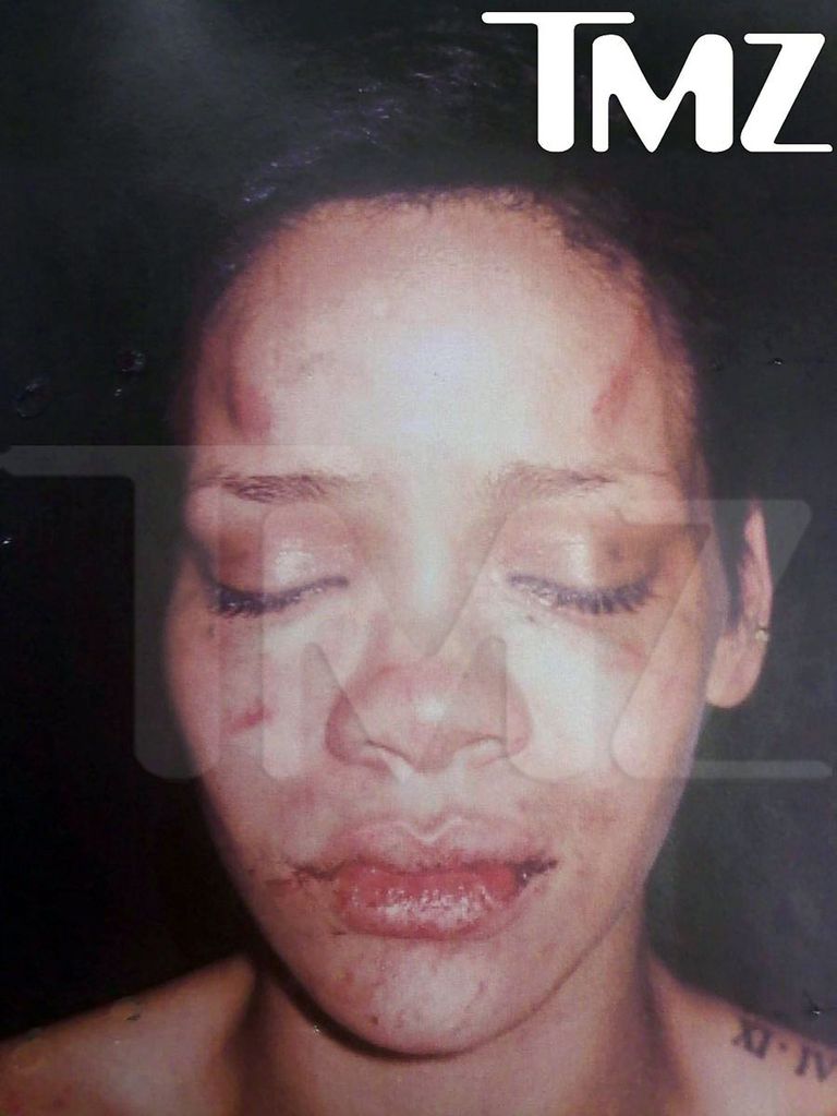 Rihanna pärast rünnakut 2009. aastal.