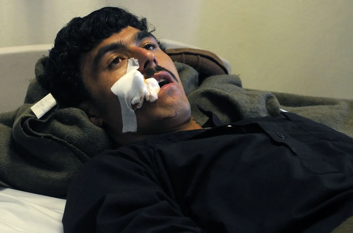 6. juunil Kandahari õhuväebaasi tabanud suitsiidirünnakus viga saanud mees kohalikus haiglas, üks ligi 2000 tänavu esimesel poolaastal sõjas vigastatud afgaanist.