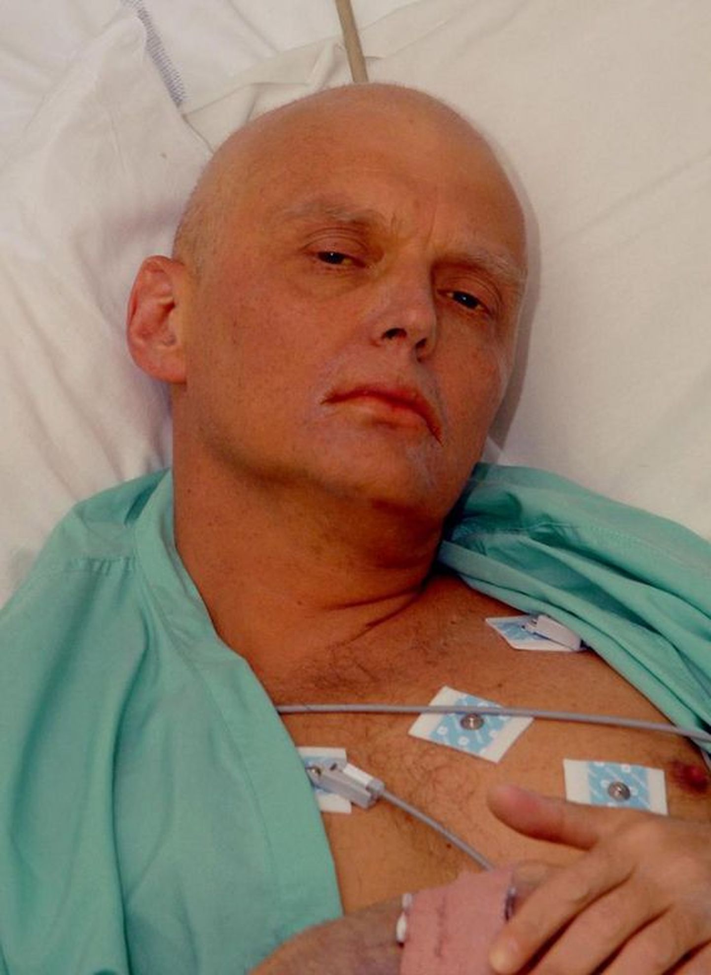 Foto haiglavoodis lebavast Aleksandr Litvinenkost.