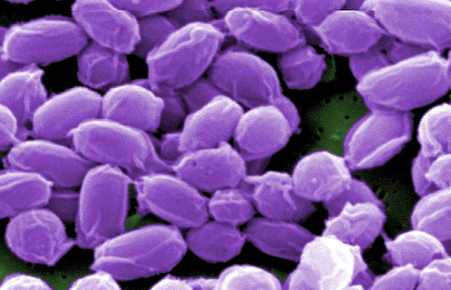 Siberi katku spoorid