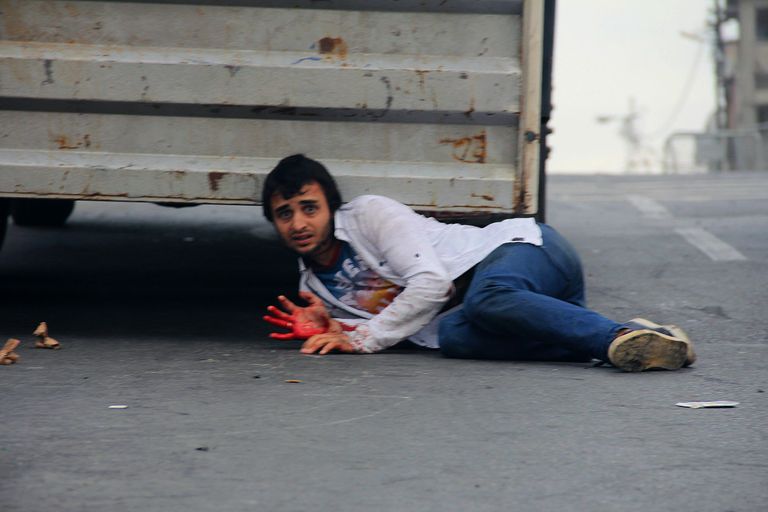 Vigastatud mees Sultanbeylis