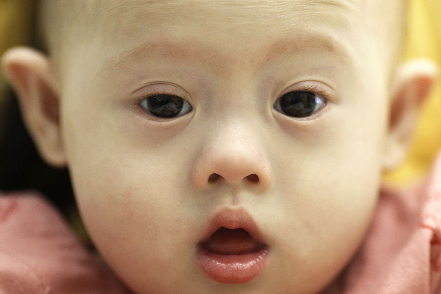 Downi sündroomiga beebi Gammy kasvab Tai kasuperes.