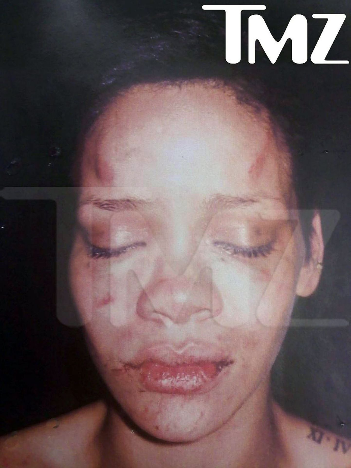 Rihanna pärast rünnakut 2009. aastal