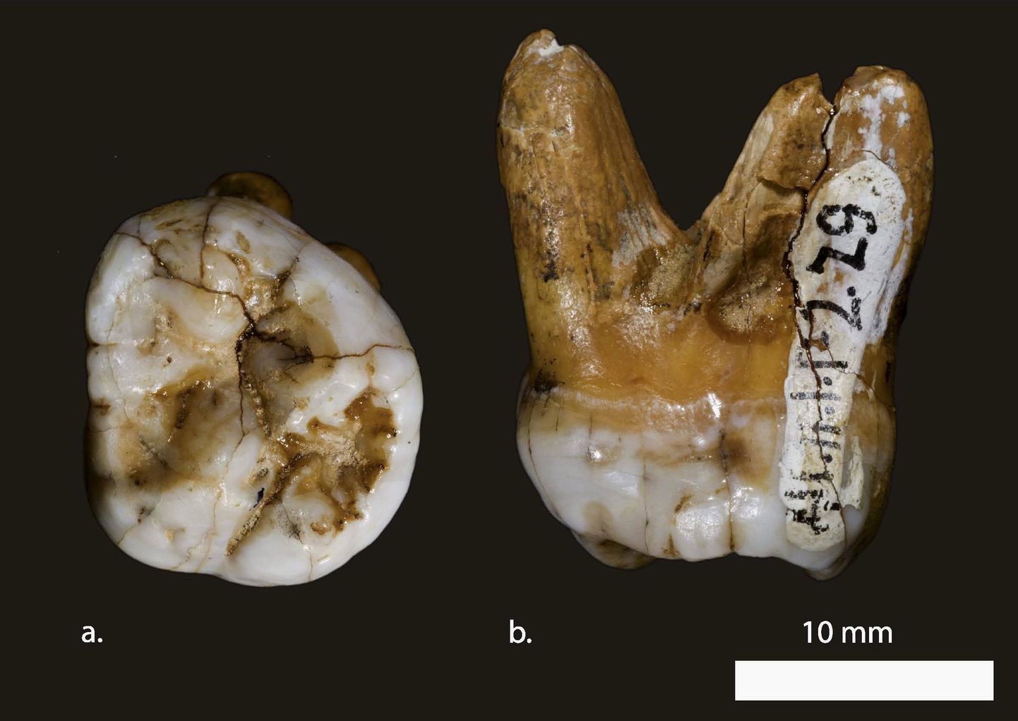 Neandertallase hammas