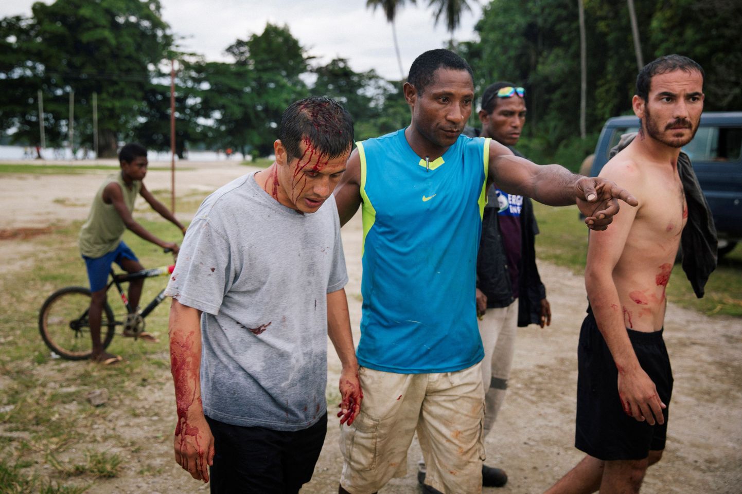 Vigastatud põgenikud Manuse saarel, peale grupi kohalike rünnakut