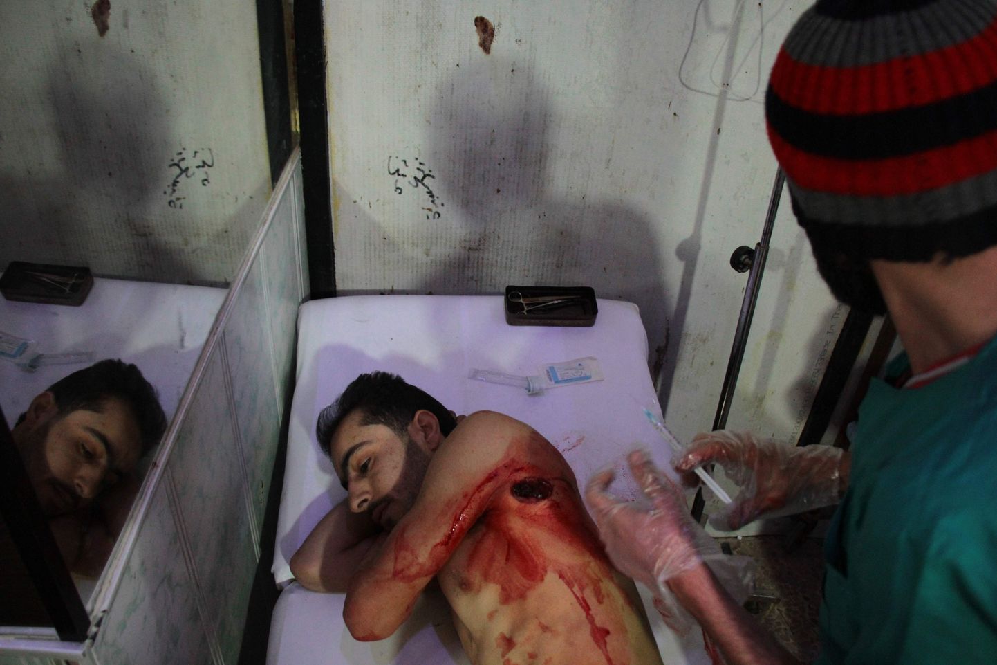 Doumas laupäeval haavata saanud mees.