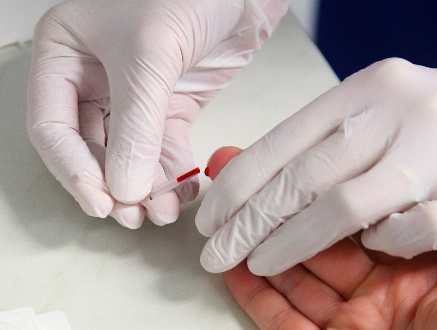 Vereproovi võtmine HIVtesti jaoks.