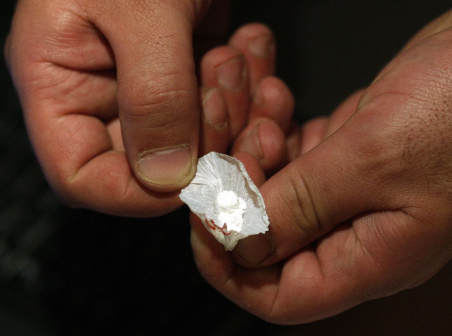 Röntgen paljastas mehe maost 123 narkootikumidega kondoomi