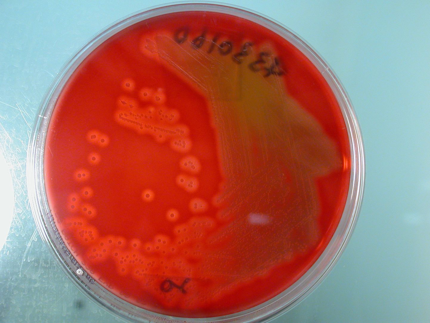 Streptococcuse bakterid