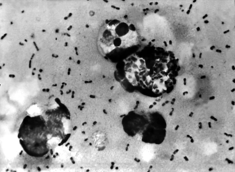 Muhkkatku põhjustavad Yersinia pestis bakterid.