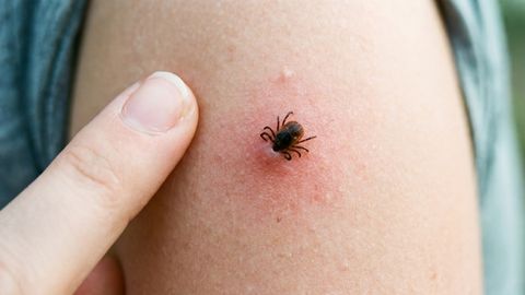 Borrelioosijuhtusid pea sama palju kui mullu