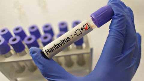 Hantavīrusa uzliesmojuma risks Eiropas iedzīvotājiem ir ļoti zems, norāda eksperti