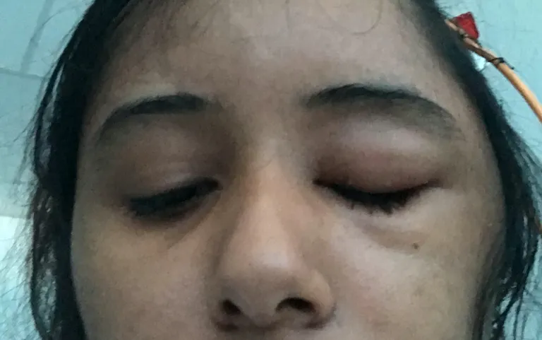 Gurcharan Kaur haiglas peale operatsiooni.