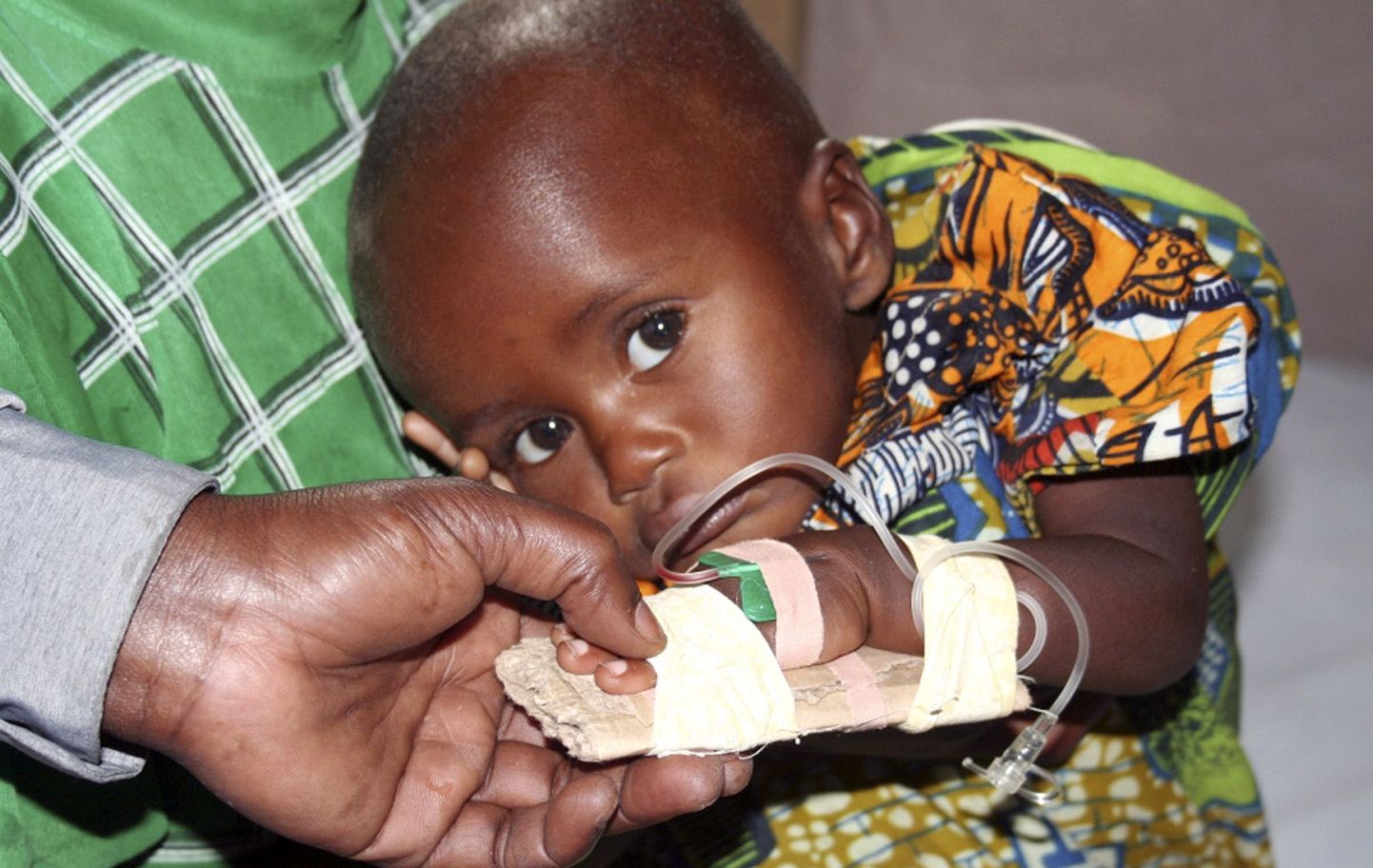 Malaariat põdev Kongo laps.