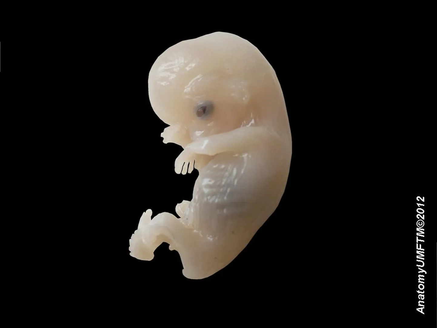 Inimese embrüo ehk idulane