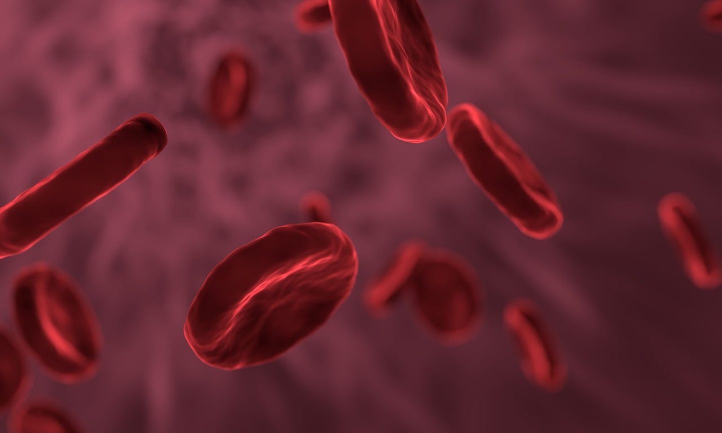 Sirprakuline aneemia on haigus, mille korral organismi toodetava ebanormaalse hemoglobiini tõttu on punaliblede kuju moondunud.