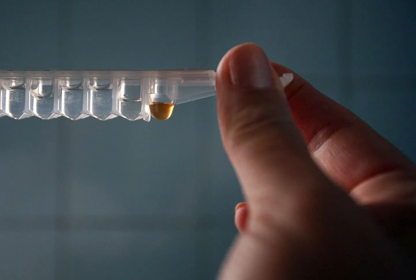 HIV-testi uurimine.