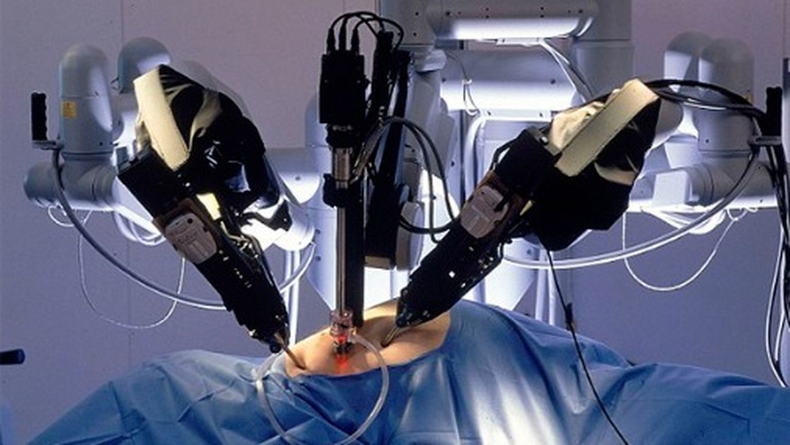 Удаление простаты роботом. Роботы в хирургии. Робот хирург да Винчи. Робот проводит операцию.