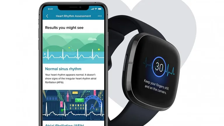 Fitbiti EKG funktsioon ei ole kahjuks Eestis saadaval.