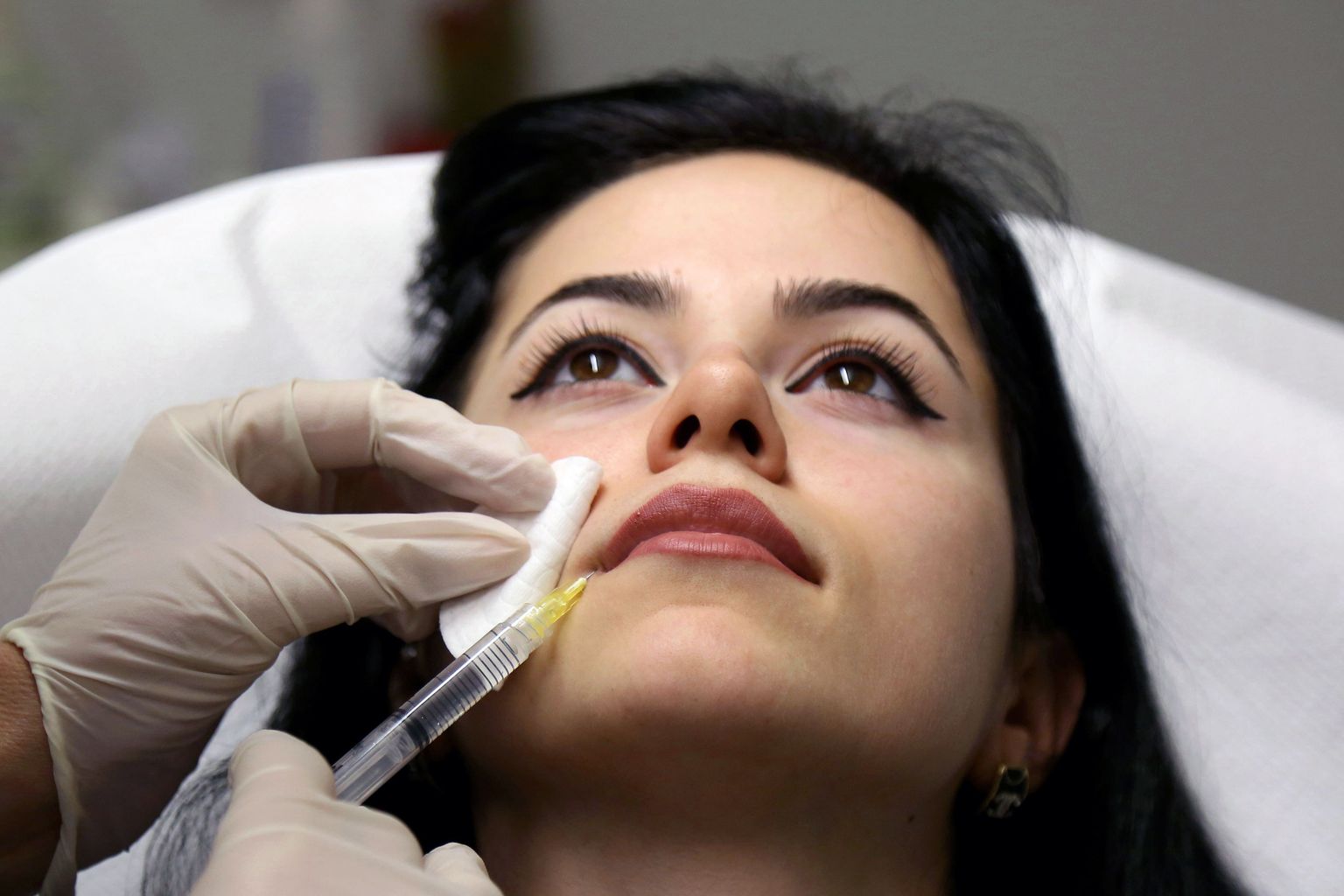 Dermatologist Monika Fida (not pictured) gives to a woman a lip augmentation injection of hyaluronic acid at her clinic on January 10, 2017. 
Emira Sela covers her face with her hand to hide a disfiguring abscess, the traumatic result of unregulated cosmetic treatments now rampant across Albania. The 31-year-old began to worry when wrinkles appeared on her face. Sela's hairdresser told her that a simple injection, costing around 60 euros ($65), would banish the signs of ageing.
 / AFP PHOTO / GENT SHKULLAKU