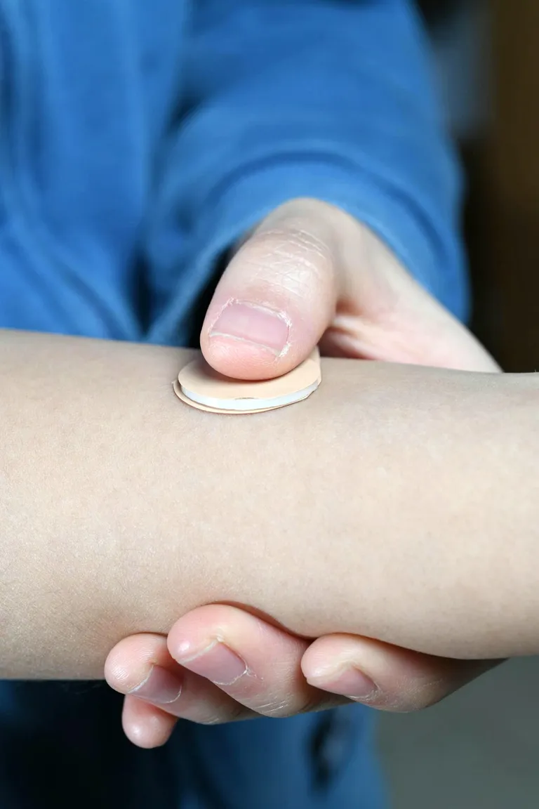 Praegu kasutusel olevaid plaastreid tuleb kanda pidevalt, uus vahend tuleb nahale asetada vaid mõneks sekundiks, et ravim vabastuks.