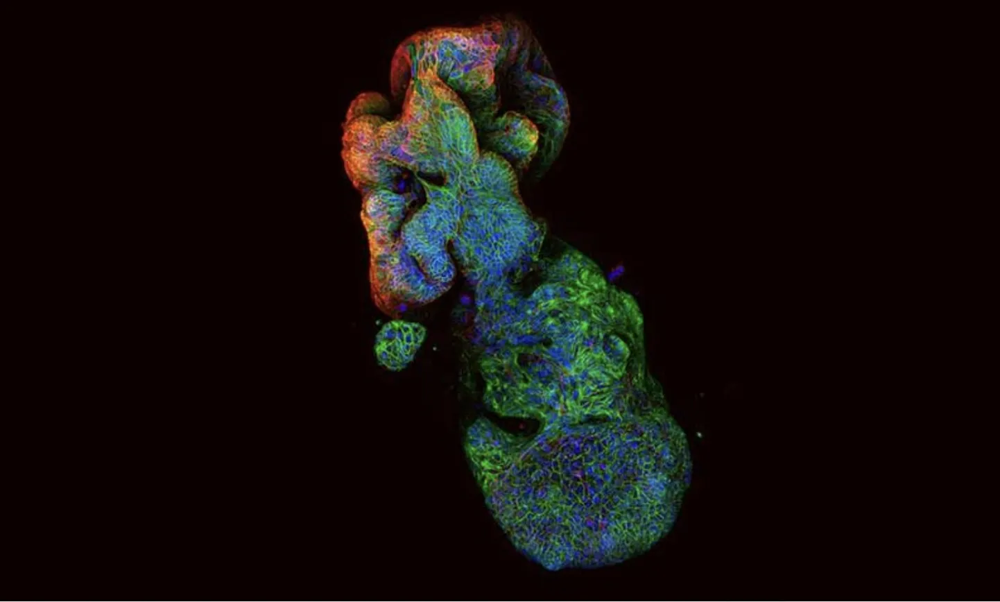 See põievähi organoid on kõigest liivatera suurune. Kujutis on loodud koodvärvilisena, et demonstreerida erinevate geenide toimimist. organoidis.