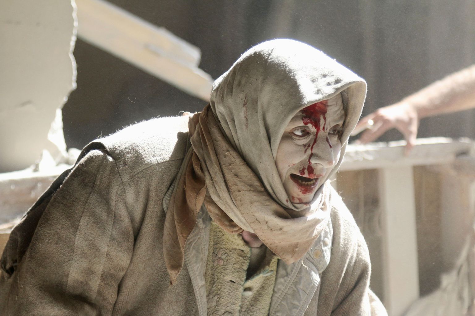 Õhurünnakus Aleppole vigastada saanud naine.