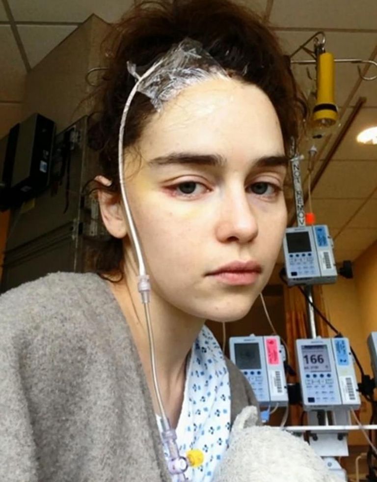 Эмилия Кларк после операции.