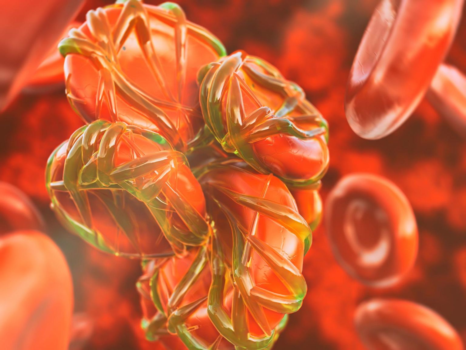 Koroonaviirusega kokku puutunud trombotsüüdid, mis aitavad moodustada verehüübeid, muutuvad veresooni kahjustava protsessi vahelüliks.