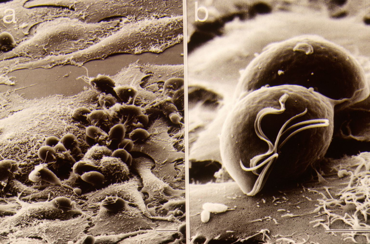 Trichomonas vaginalis elektronmikroskoobiga vaadates - vasakul on algloomad end sisse seadnud epiteelirakkudel, paremal aga on kahe parasiidi kujutis.