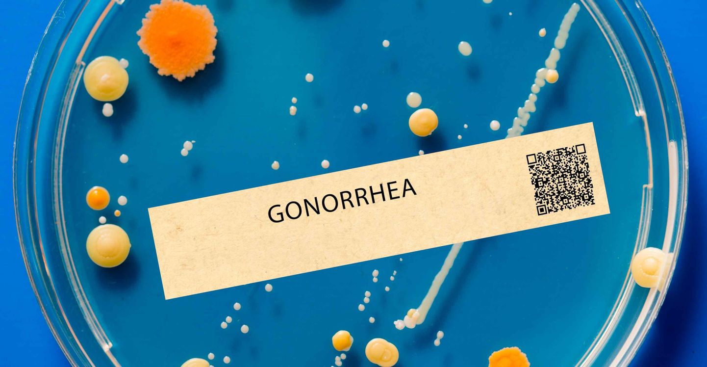 Gonorröad põhjustab Neisseria gonorrhoeae bakter ehk gonokokk.