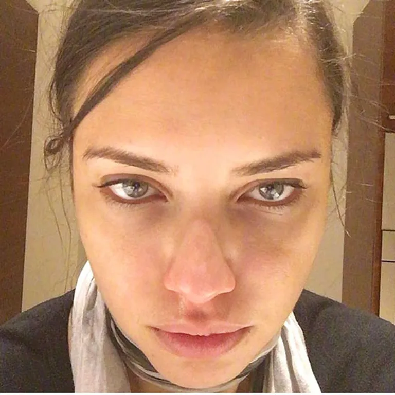 Raksta foto
