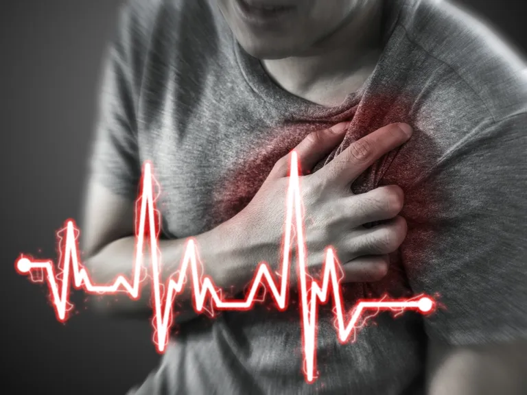 Infarkt. Pilt on illustreeriv