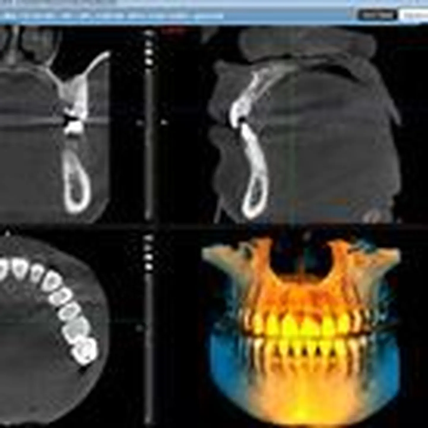 3D-röntgenaparaat võimaldab teha hammastest digitaalset panoraamülesvõtet ja 3D-röntgenülesvõtet ühe seadmega.