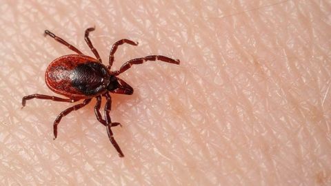 Korduma kippuvad küsimused: Mis juhtub, kui puugi pea jääb naha sisse?