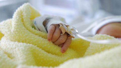 Синдром Дауна: мальчик, рожденный вопреки