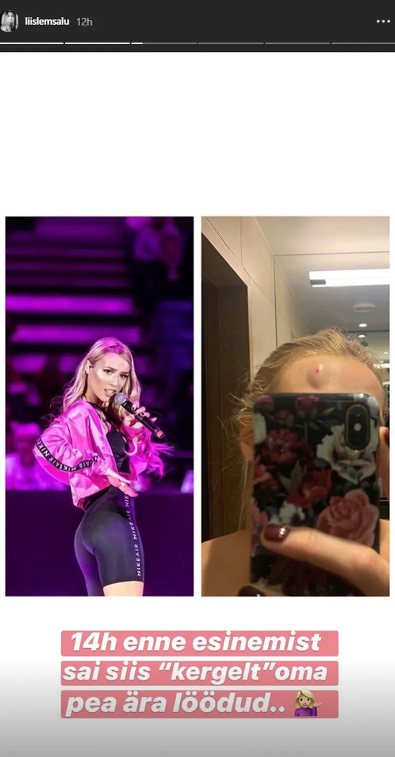 Lemsalu sai muhu 14 tundi enne esinemist.