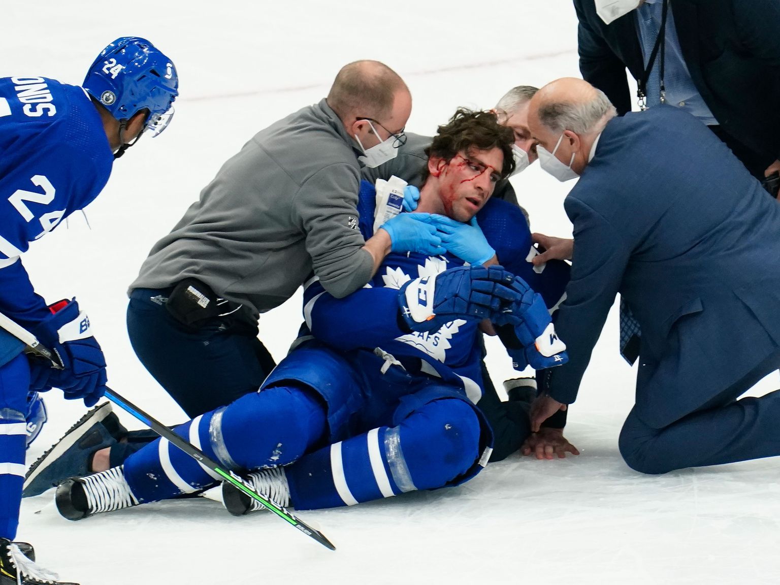 Läinud ööl peetud NHLi play off kohtumises sai kohutaval viisil vigastada Toronto meeskonna kapten John Tavares.