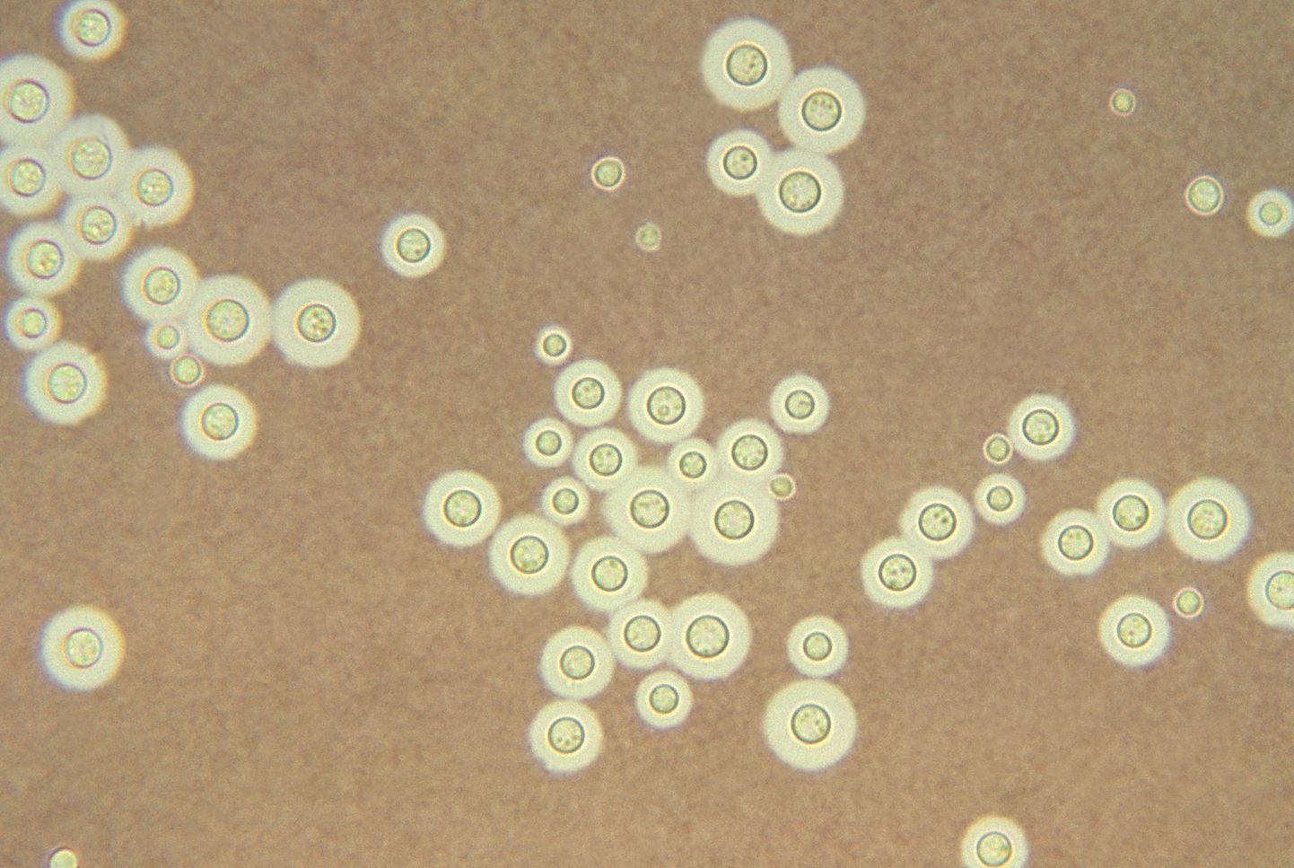 Radiotrofiskā sēne "cryptococcus neoformans"