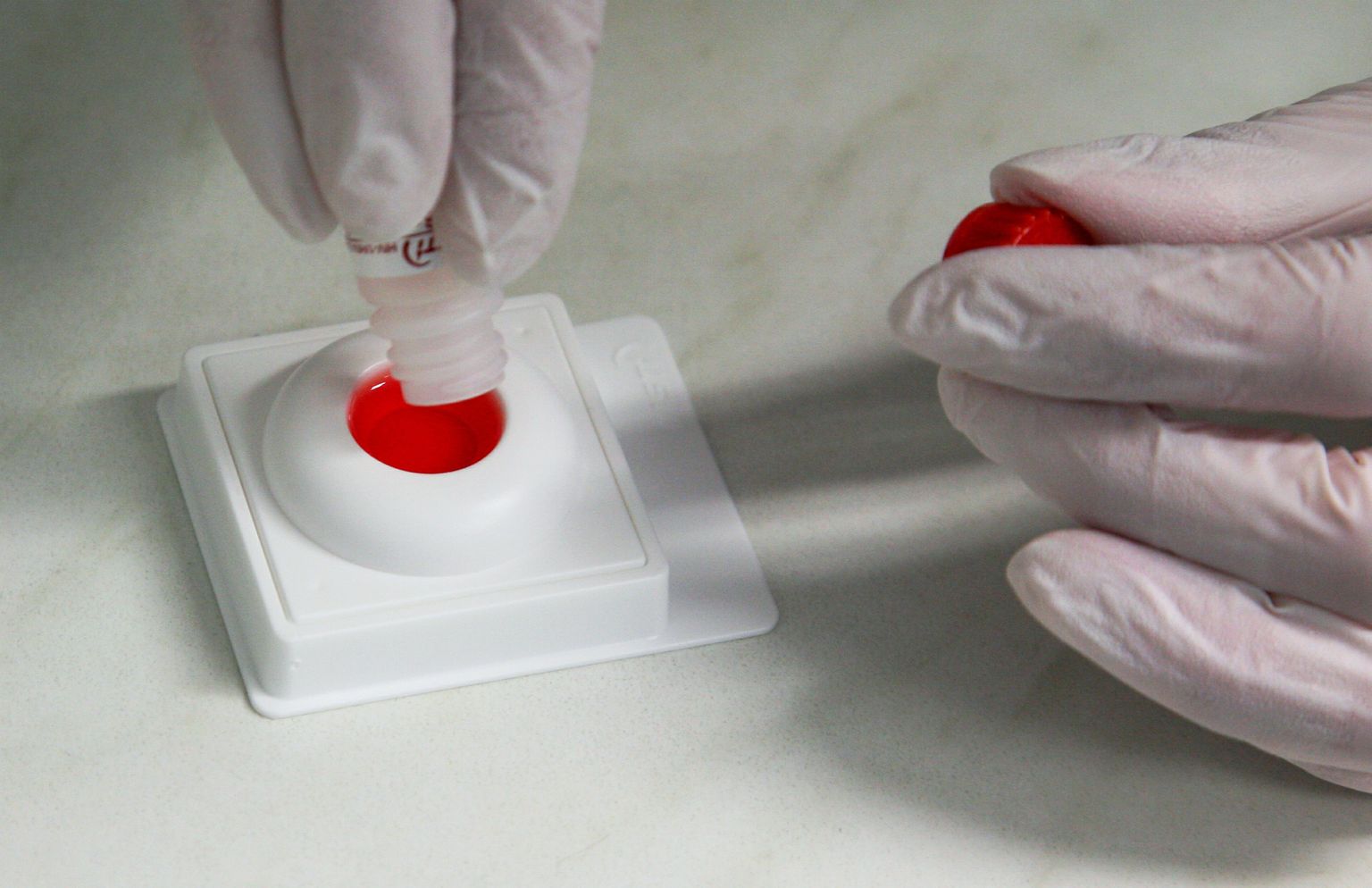 Aidsi kabinet Pärnu haiglas. HIVi kiirtesti komplekt. Pildil verelahuse valamine testrile.