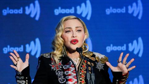 ФОТО ⟩ «Отек спал, я привлекательна»: Мадонна показала лицо после пластической операции