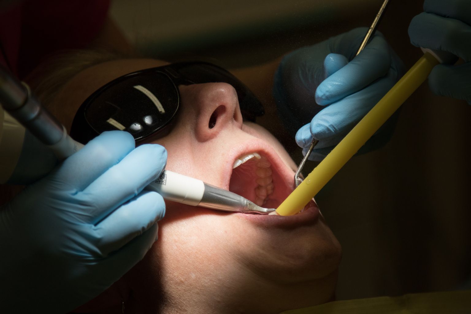 Täiskasvanute hambaravihüvitist saab Viljandimaal kasutada 12 kohas, millest pooled asuvad Viljandis.