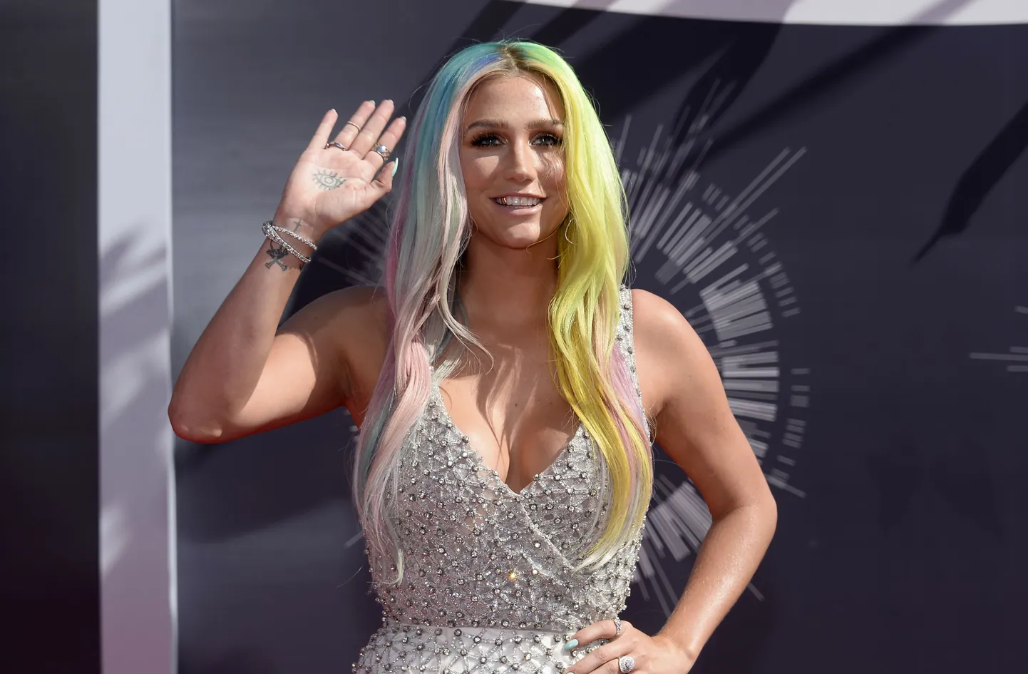 Kesha.