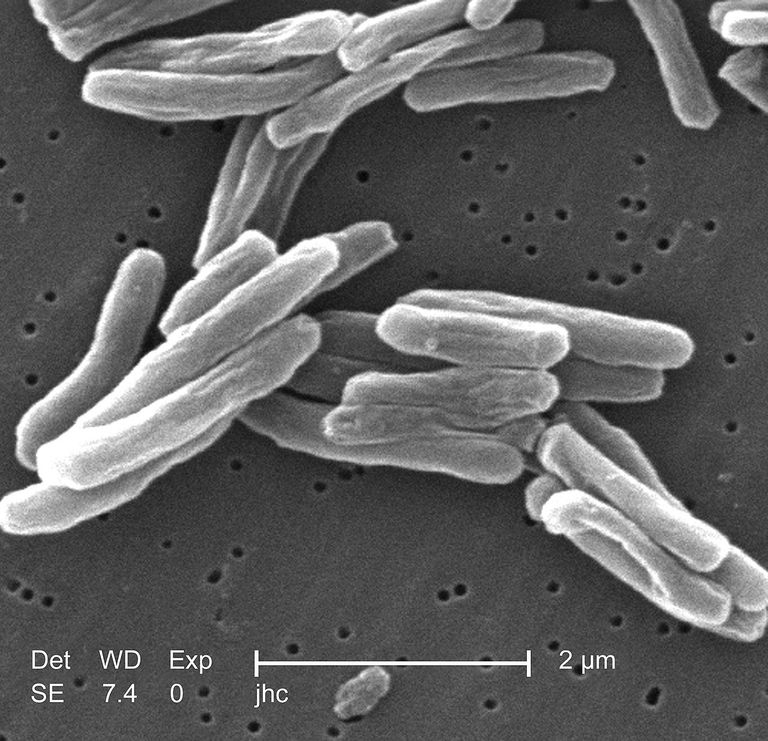Tuberkuloosibakterid elektronmikroskoobis.