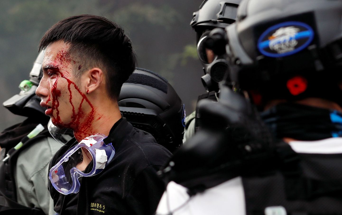 Märulipolitsei vigastatud tudengiga Hongkongi põlütehnilise ülikooli linnakus.