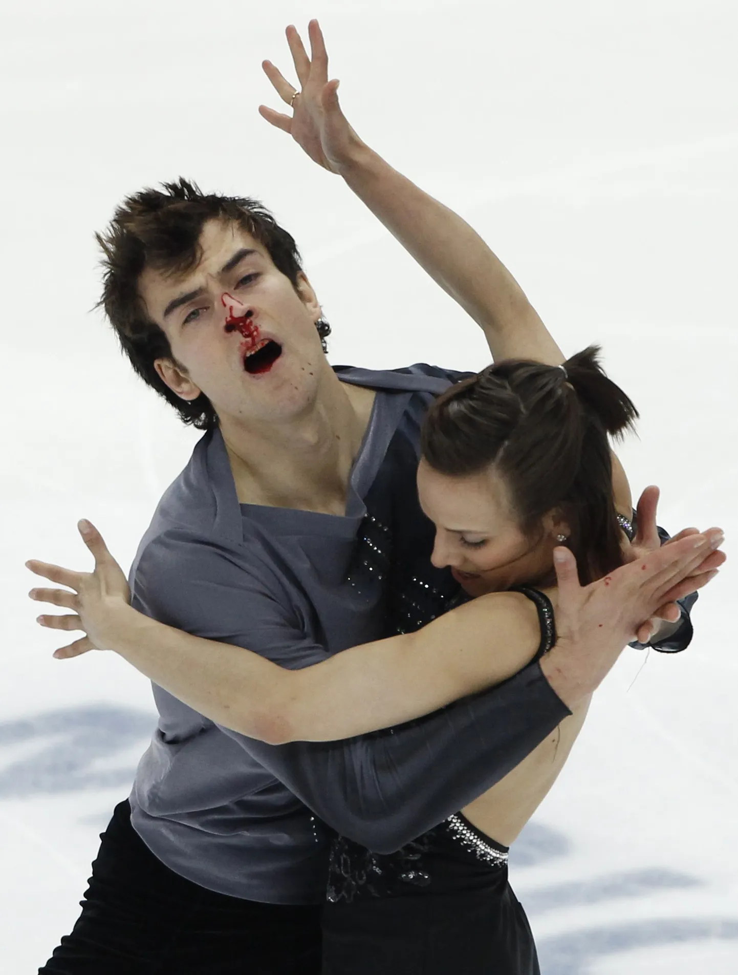 Eric Radford sai lühikava ajal oma partnerilt Meagan Duhamelilt kogemata küünarnukiga näkku ja murdis ninaluu.